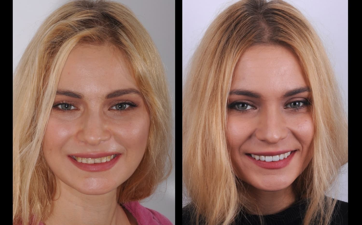 Denti veri. Pazienti veri.
