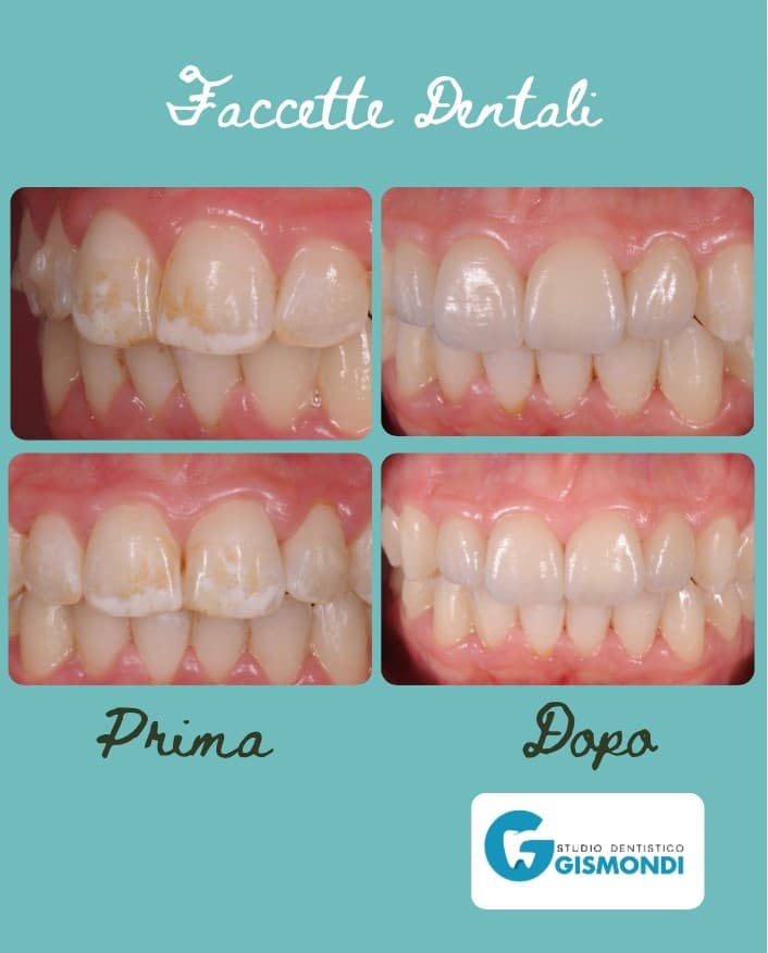 Denti veri. Pazienti veri.
