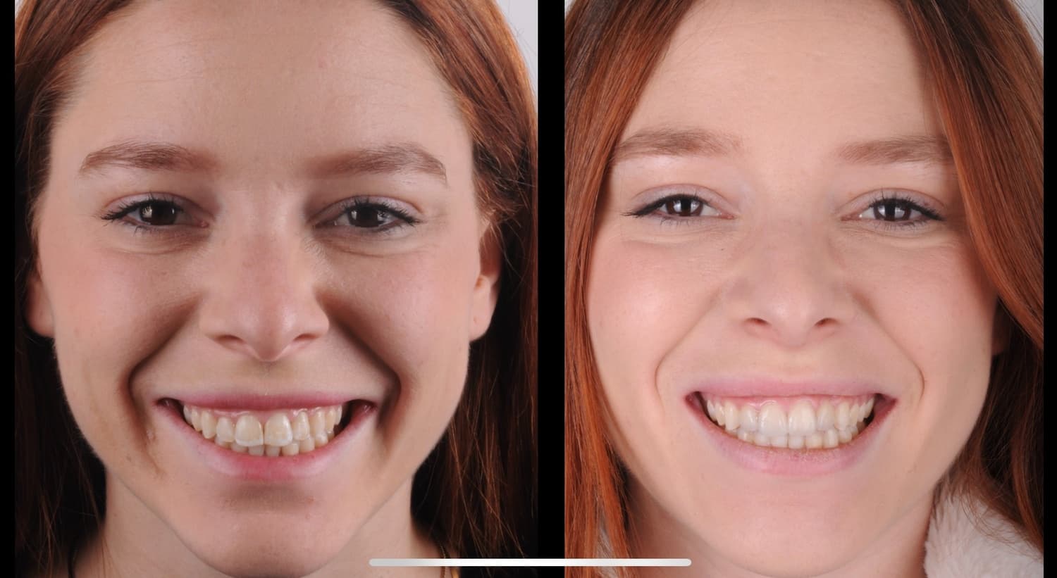 Denti veri. Pazienti veri.